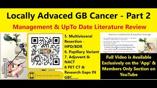 Locally Advanced GB Cancer Management amp Review Series Part 23 See Video Description for Details [upl. by Teodora]