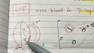 Hyperaemia amp Congestion  CVC Lung  TAMIL [upl. by Gnet56]