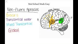 NonFluent Aphasias Made Easy How to Distinguish and Remember Them [upl. by Sukram]