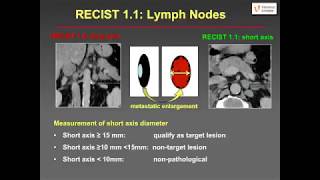 CT in oncology  Assessment of tumor response RECIST and its challenges [upl. by Arual]