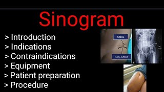 Sinogram  indication  Contraindications procedure Complete study  by BL Kumawat [upl. by Channa]