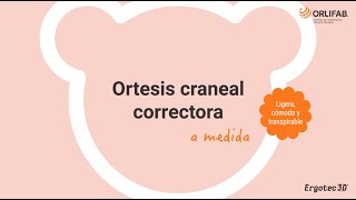 Ortesis craneal correctora a medida [upl. by Nnairrek354]