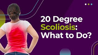 20 Degree Scoliosis What to Do [upl. by Haslett828]