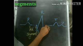 What does PQRST ECG waves represents segments and intervalswhat they denotemore about P wave [upl. by Aerdna]