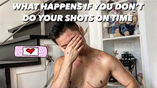 FTM’s GUIDE EP 30 WHAT HAPPENS WHEN YOU DON’T TAKE YOUR SHOTS ON TIME 💉 [upl. by Elvis533]