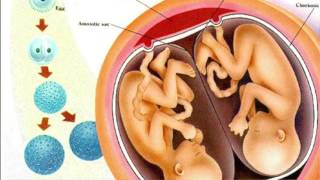 Everything You Need To Know About Fraternal and Identical Twins  Dr Sarah Finch [upl. by Nodnal48]