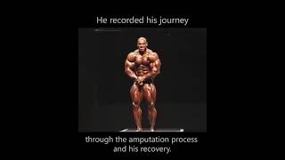 Flex Wheeler Amputation Life Trailer Video [upl. by Norty311]