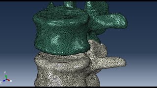 L2 and L3 lumbar vertebrae meshing using abaqus [upl. by Helene]