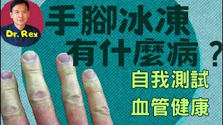 中英字幕EngSub手腳冰凍會有什麼病？教你簡單方法不花錢立即知道血管健康！cold hands and feet what are the implications [upl. by Ahsirpac]