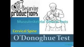 ODonoghue Test Musculoskeletal Clinical Tests [upl. by Clint]