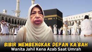 Kisah Nyata Wanita Asal Indonesia Terkena Azab Bibirnya Membesar Saat Umrah [upl. by Nickolai686]