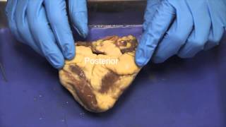 NAU BIo 202 Lab 3  Sheep Heart Dissection [upl. by Brose]