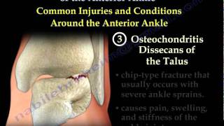 Anatomy and injuries of the Anterior Ankle  Everything You Need To Know  Dr Nabil Ebraheim [upl. by Pompea638]