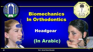 Use of Headgear in Orthodontics In Arabic [upl. by Nhtanhoj]