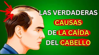 Causas y soluciones naturales para la caída del cabello Guía completa [upl. by Ellehcear849]