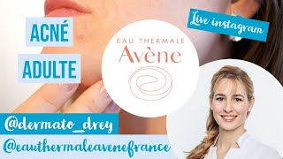 Live Dermato Drey et Avène  acné de ladulte boutons quotimperfectionsquot [upl. by Okuy242]