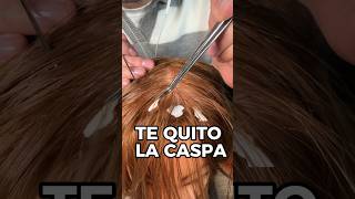 TE QUITO LA CASPA asmr shorts asmrvideo comedia [upl. by Dj307]