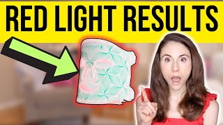 DO LED LIGHT MASKS REALLY WORK  Dermatologist reviews Omnilux [upl. by Nnywg356]