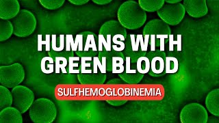 Humans with green blood  Sulfhemoglobinemia [upl. by Sydelle]