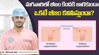 What is Undescended Testicle and How to Treat That  Cryptorchidism Causes  Dr Abhilash Nali [upl. by Gnourt]