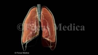 Hemothorax  Lungs [upl. by Nicolas]