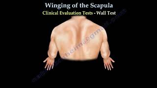 WINGING OF THE SCAPULALONG THORACIC NERVE  Everything You Need To Know  Dr Nabil Ebraheim [upl. by Ax639]