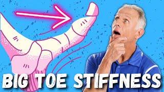 Big Toe PainStiffness Hallux Rigidus 10 Steps to Cure [upl. by Afra]