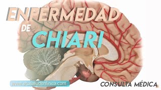 Sistema nervioso Enfermedad de Arnold Chiari [upl. by Aneeb]