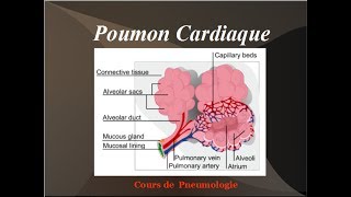 Poumon Cardiaque Oedeme aigu du poumon OAP Physiopathologie de linsuffisance cardiaque gauche [upl. by Laws470]