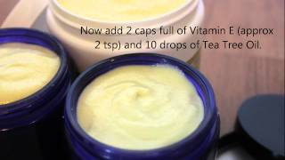 How to Whipped Shea Butter for Dry skin Eczema [upl. by Arinaid581]