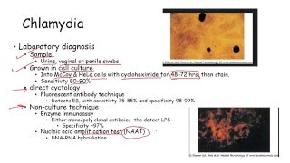 Sexually transmitted diseases STD in women and men syphilis chlamydia gonoirrhoeae and hermes [upl. by Walworth623]