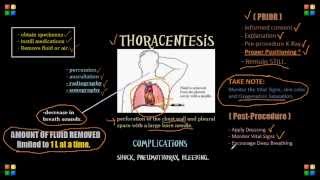 Thoracentesis NCLEX Review Important Content [upl. by Terese]