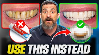 Neuroscientist quotToothpaste Is Damaging Your Teethquot How To Take Care of Your Teeth [upl. by Luzader]