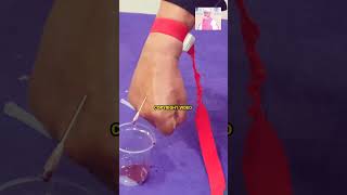 PROF DR MD AHSAN FAROQUI venesection hijama hijamacupping short shorts trendingshorts [upl. by Yekcir]