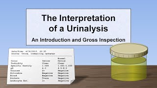 Interpretation of the Urinalysis Part 1  Introduction and Inspection [upl. by Marcello]