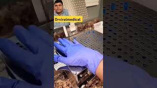 capsule medicine making process shortsvideo viralshort drviralmedical [upl. by Akem]