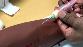 Venepuncture PLAB 2 Samson Academy  Mo Sobhy  Common Stations [upl. by Nehtiek234]