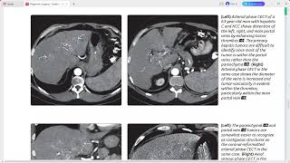 LIVER DIAGNOSTIC IMAGING SERIES [upl. by Burleigh]