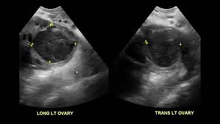 Abdominal Case Conference  812023 [upl. by Llirpa]