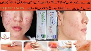 Fusiderm Cream Uses In urdu  Fusiderm Cream How to Use  Best product for you [upl. by Blackington]