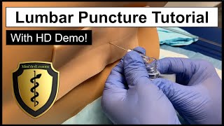 Lumbar Puncture Spinal Tap  Comprehensive Tutorial amp Demonstration [upl. by Mickey593]