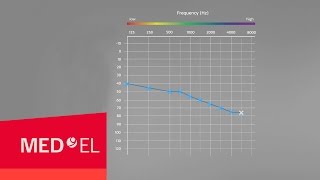 Audiograms Explained  MEDEL [upl. by Ahsilad229]