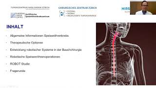 Speiseröhrenkrebs und Robotik Was ist heutzutage möglich [upl. by Primaveras]