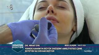 Ameliyatsız Burun Estetiği Aquafilling Dolgu  Dr Nihat Dik [upl. by Nac147]