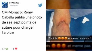 OMMonaco Rémy Cabella publie une photo de ses sept points de suture pour charger larbitre [upl. by Noslen]