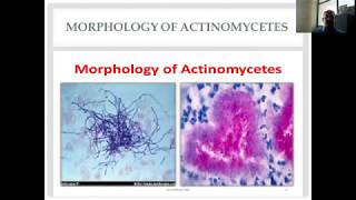 Actinomycetes and Nocardia Diverse Group of Gram Positive Bacilli [upl. by Nivahb]