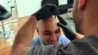 Inside Look Scalp Micropigmentation Treatment  Scalp Micro USA [upl. by Idarb738]