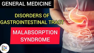 MALABSORPTION SYNDROME  DISORDERS OF GASTROINTESTINAL TRACT [upl. by Conan]