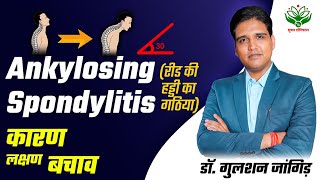 रीढ़ की हड्डी का गठिया  Ankylosing Spondylitis  Symptoms amp Treatment in Hindi  Dr Gulshan Jangir [upl. by Godding926]