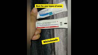 shorts Benefits of Adapalene gel 01 Differin gel for acne adapalene differingel [upl. by Elyse]